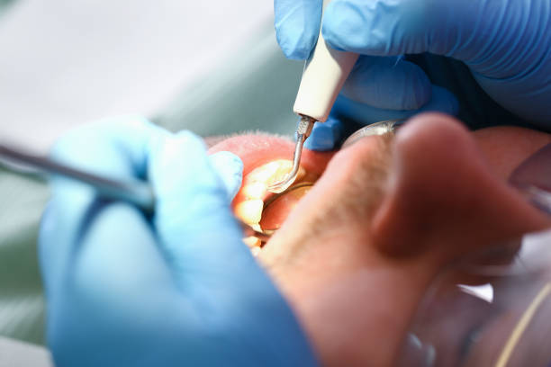 Best Emergency Treatment for Jaw Pain or Injury in Sterling, AK