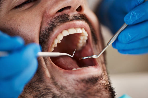 Best Emergency Dental Care for Sports Injuries in Sterling, AK
